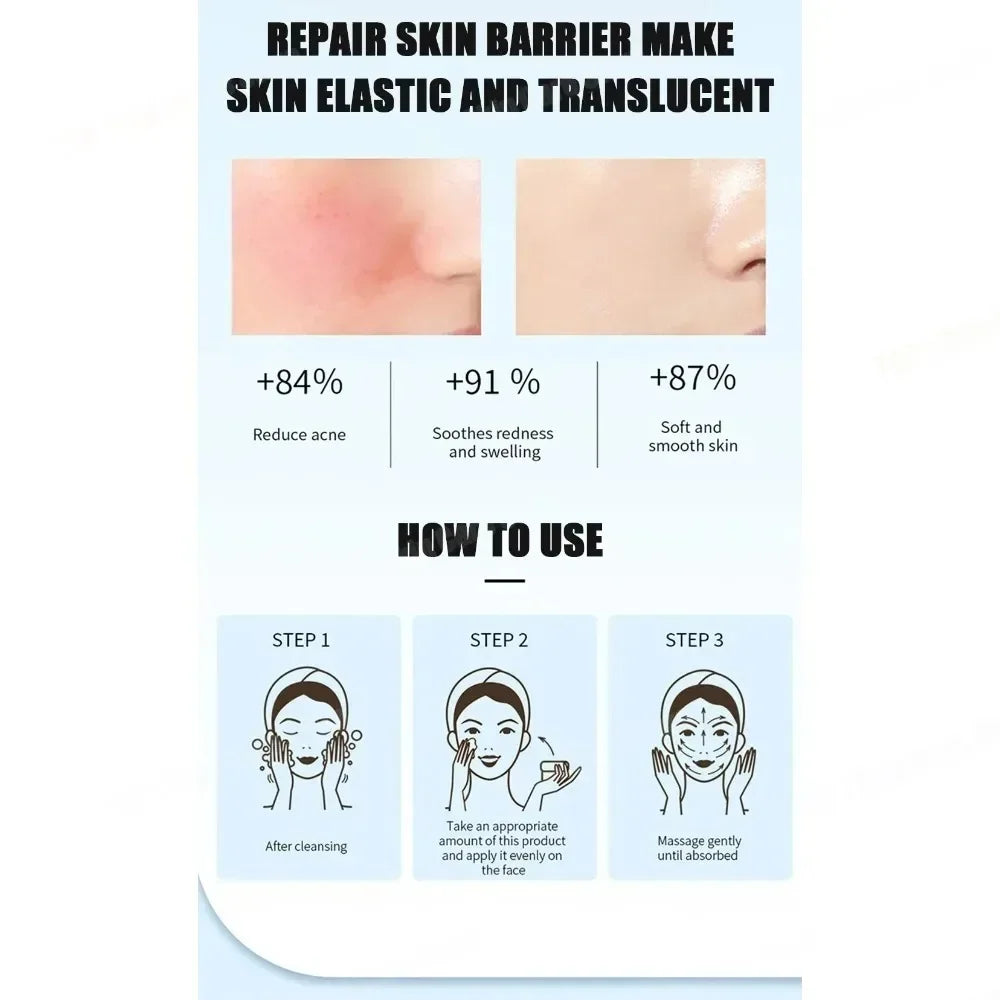 Suero facial con ácido de frutas para el acné