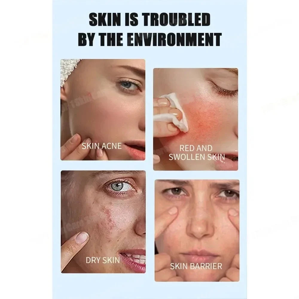 Suero facial con ácido de frutas para el acné