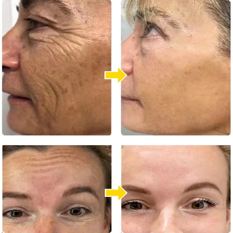 100 g de mucina de caracol con colágeno